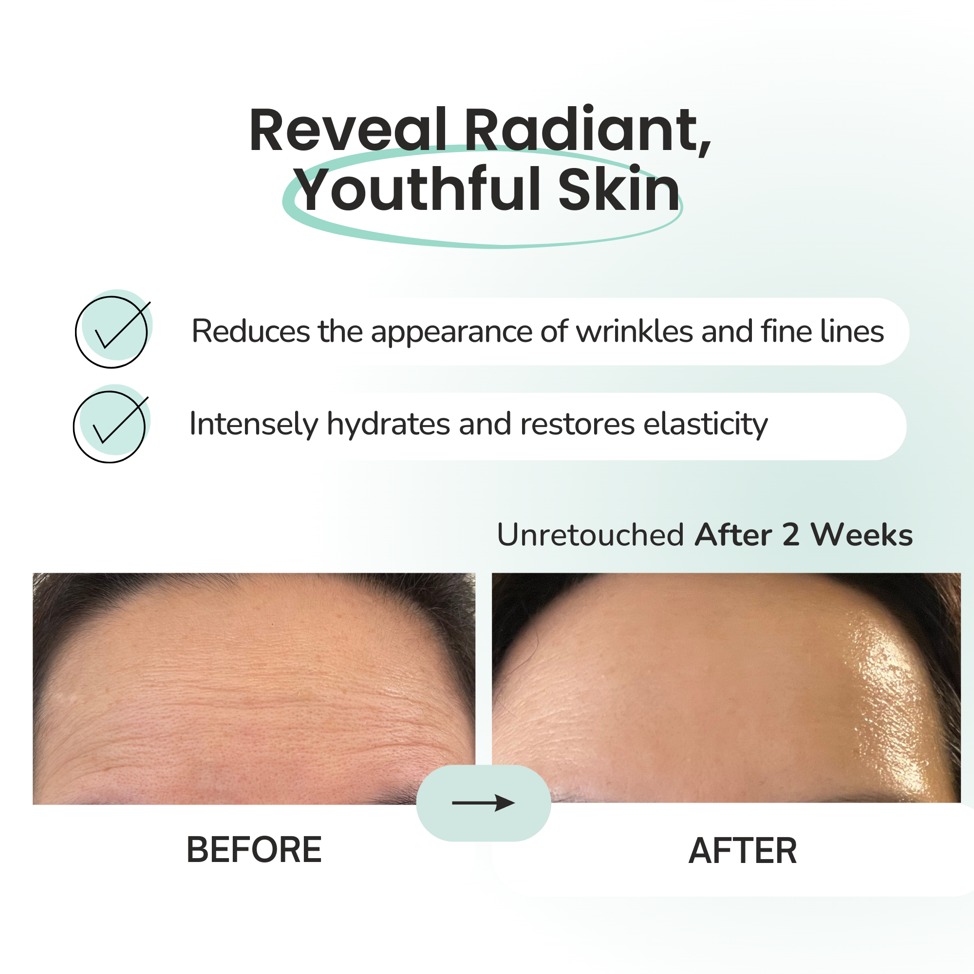 Hydrogel Forehead & Neck Patch – Intensive Hydration & Firming Care