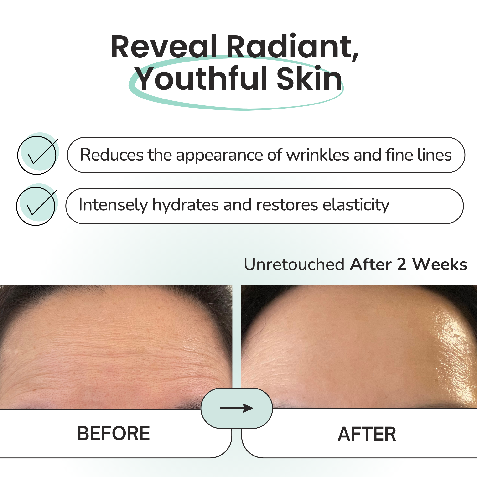 Hydrogel Forehead & Neck Patch – Intensive Hydration & Firming Care