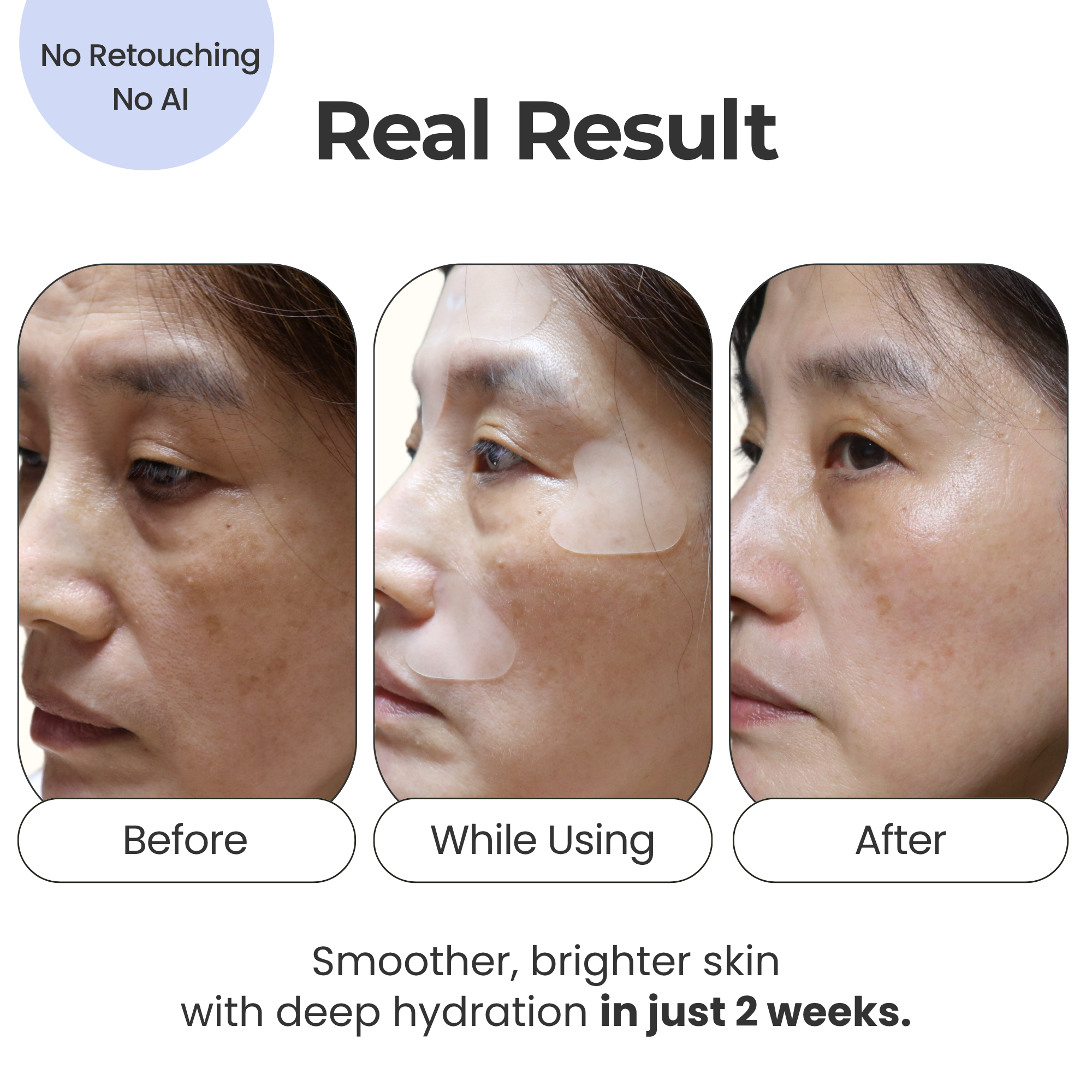 Face Wrinkle Patches