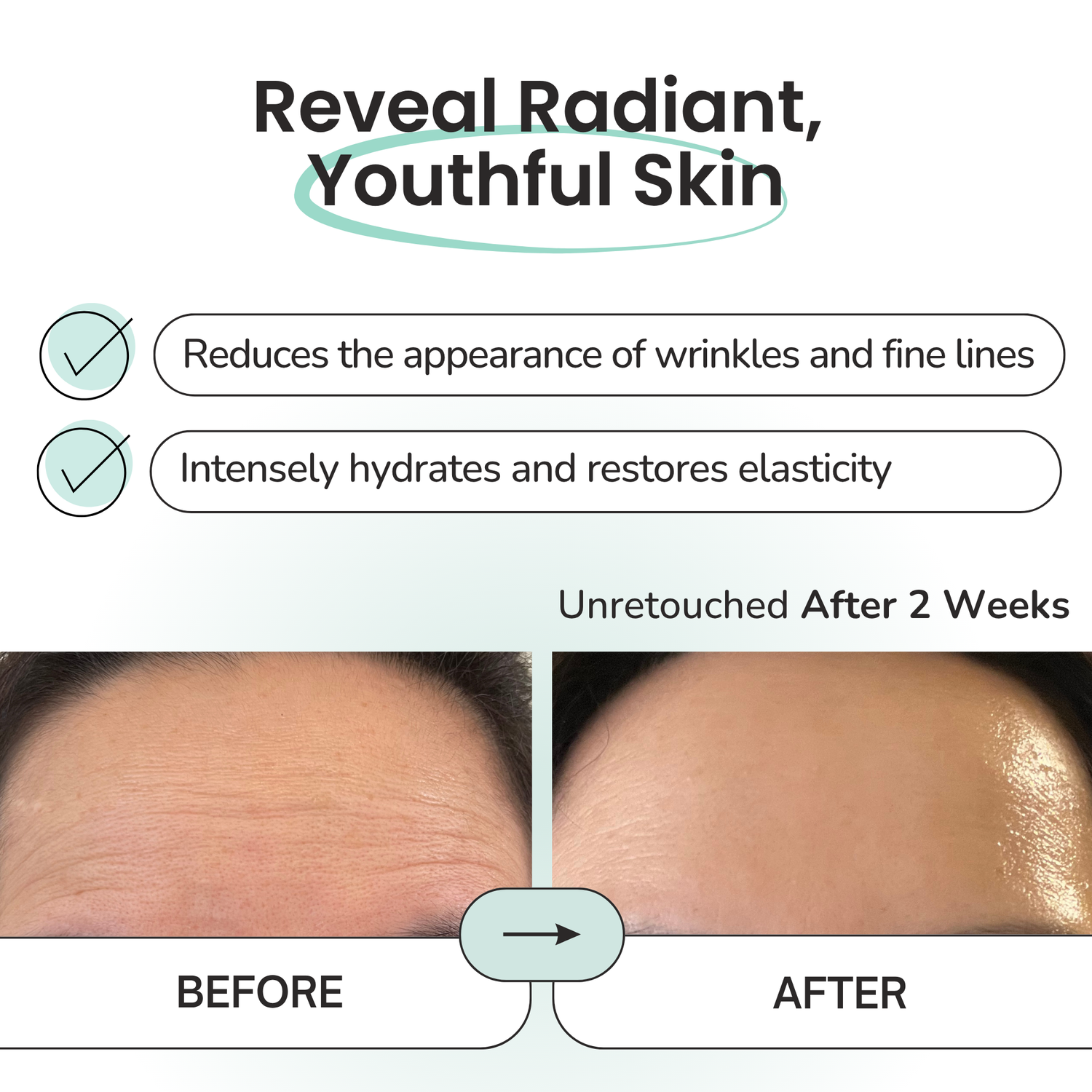 Hydrogel Forehead &amp; Neck Patch – Intensive Hydration &amp; Firming Care