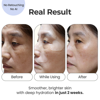 Face Wrinkle Patches